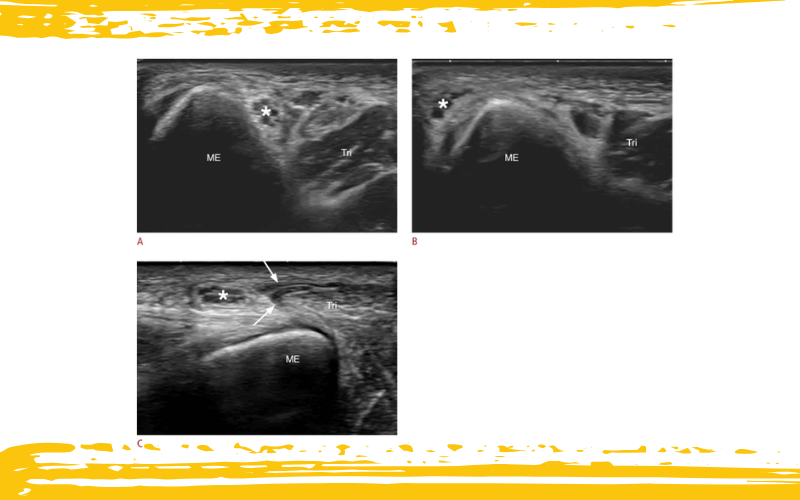 7. Diagnostico diferencial parte 1 ecografia tempo formacion.png